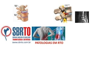 www.sbrto.com.br

PATOLOGIAS EM RTO

 