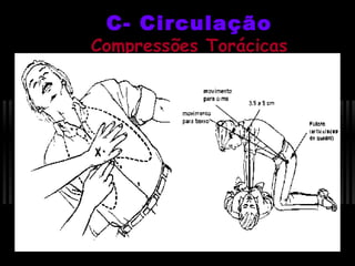 C- Circulação

Compressões Torácicas

 