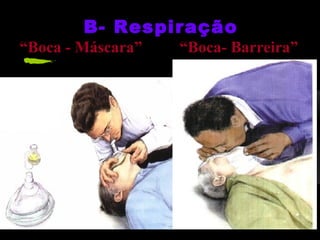 B- Respiração

“Boca - Máscara”

“Boca- Barreira”

 