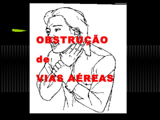 OBSTRUÇÃO
de
VIAS AÉREAS

 