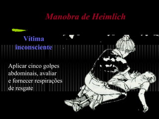 Manobra de Heimlich
Vítima
inconsciente
Aplicar cinco golpes
abdominais, avaliar
e fornecer respirações
de resgate

 