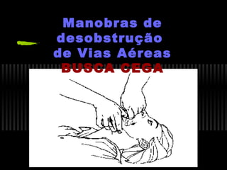 Manobras de
desobstrução
de Vias Aéreas
BUSCA CEGA

 