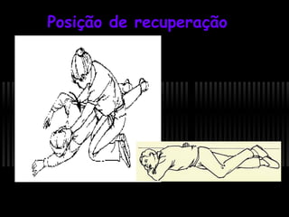 Posição de recuperação

 
