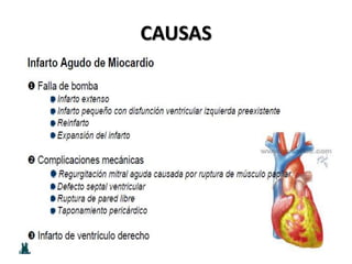 CAUSAS