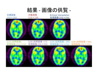 Bi-linear interpolation
(256 256)(256 256) (128 128)
- -
ScSR ( + NM)
(256 256)
ScSR ( + MR)
(256 256)
ScSR ( )
(256 256)
ScSR ( + CT)
(256 256)
 