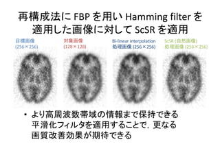 Bi-linear interpolation
(256 256)(256 256) (128 128)
FBP Hamming filter
ScSR
•
ScSR ( )
(256 256)
 