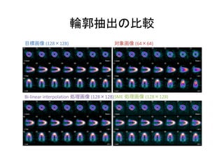 Bi-linear interpolation (128 128)
(128 128) (64 64)
SME (128 128)
 