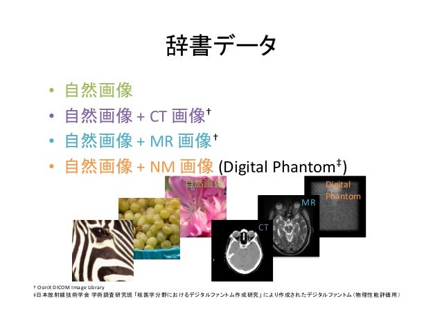 Sparse Coding Super Resolution を用いた核医学画像処理