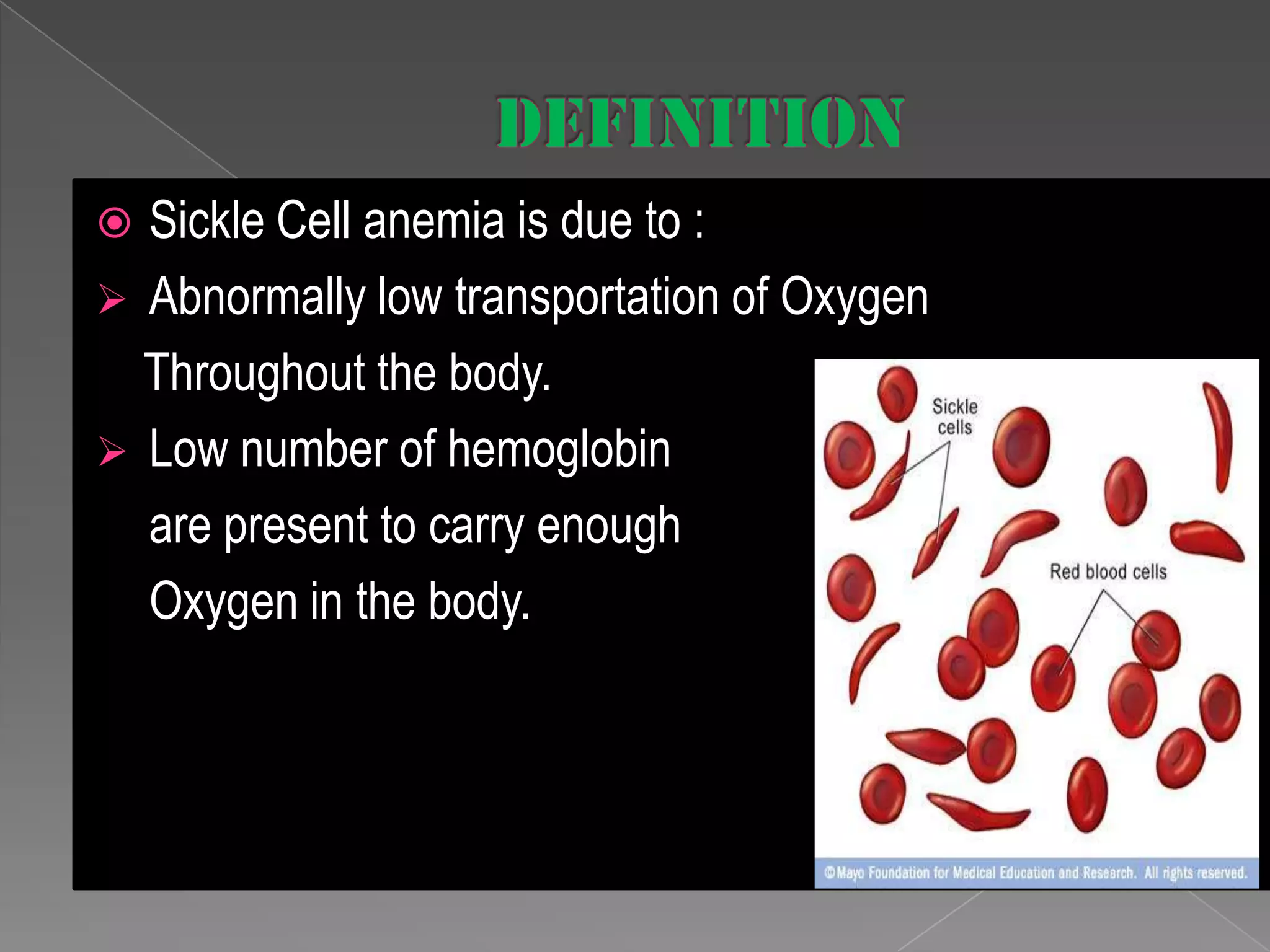 Sickle Cell Anemia | PPTX