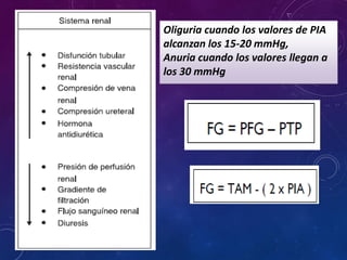 Oliguria cuando los valores de PIA
alcanzan los 15-20 mmHg,
Anuria cuando los valores llegan a
los 30 mmHg
 