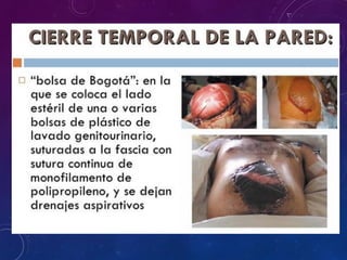 sindrome compartimental abdominal