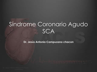 ACLS
Dr. Jesús Antonio Campuzano Chacón
Urgenciólogo
Síndrome Coronario Agudo
SCA
Dr. Jesús Antonio Campuzano chacon
 