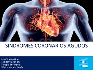 Alvaro Vargas V.
Residente 3er año
Terapia Intensiva
Clínica Modelo Lanús
SINDROMES CORONARIOS AGUDOS
 