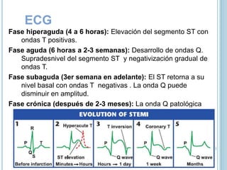 ECG
Fase hiperaguda (4 a 6 horas): Elevación del segmento ST con
ondas T positivas.
Fase aguda (6 horas a 2-3 semanas): Desarrollo de ondas Q.
Supradesnivel del segmento ST y negativización gradual de
ondas T.
Fase subaguda (3er semana en adelante): El ST retorna a su
nivel basal con ondas T negativas . La onda Q puede
disminuir en amplitud.
Fase crónica (después de 2-3 meses): La onda Q patológica
persistente. La onda T puede permanecer negativa,
isoeléctrica o recuperar su positividad.
 