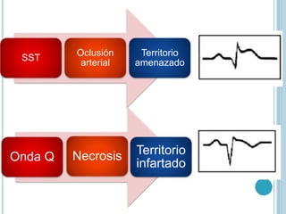 SST
Oclusión
arterial
Territorio
amenazado
Onda Q Necrosis Territorio
infartado
 