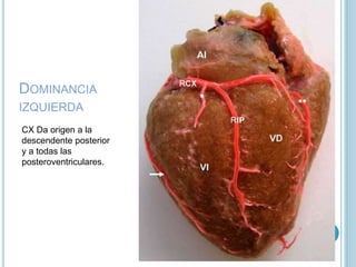 DOMINANCIA
IZQUIERDA
CX Da origen a la
descendente posterior
y a todas las
posteroventriculares.
 