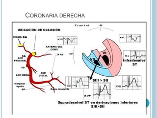 CORONARIA DERECHA
 