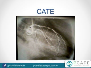 pcarefisioterapia.com.br/pcarefisioterapia
CATE
 