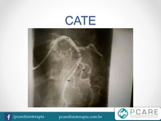 pcarefisioterapia.com.br/pcarefisioterapia
CATE
 