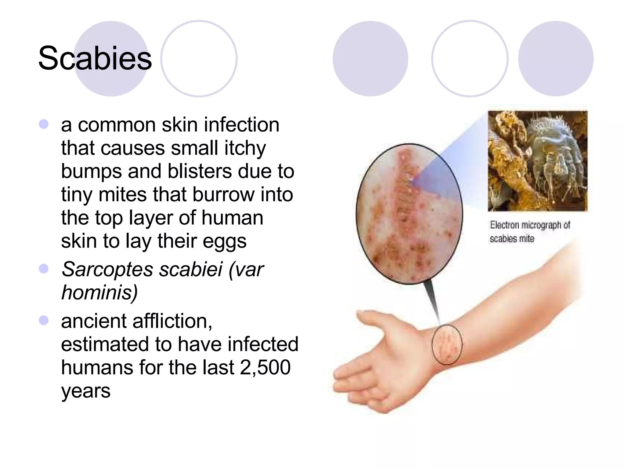 Scabies PPT
