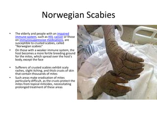 Norwegian Scabies
•   The elderly and people with an impaired
    immune system, such as HIV, cancer or those
    on immunosuppressive medications, are
    susceptible to crusted scabies, called
    "Norwegian scabies“
•   On those with a weaker immune system, the
    host becomes a more fertile breeding ground
    for the mites, which spread over the host's
    body, except the face

•   Sufferers of crusted scabies exhibit scaly
    rashes, slight itching, and thick crusts of skin
    that contain thousands of mites
•   Such areas make eradication of mites
    particularly difficult, as the crusts protect the
    mites from topical miticides, necessitating
    prolonged treatment of these areas
 