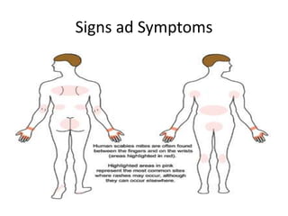Signs ad Symptoms
 