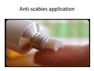 Anti-scabies application
 
