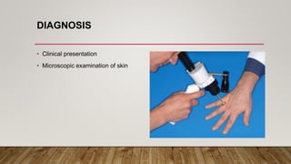 Scabies Testing Scabies | PPTX