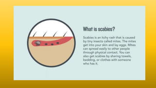 SCABIES | PPTX