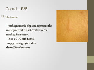 Comprehensive Overview of Parasitic Skin Infections: Scabies and Beyond ...