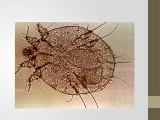 Parasite Rashes Comprehensive Overview of Parasitic Skin Infections: Scabies and Beyond ...