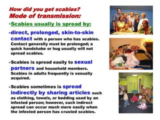 Scab Structures Comprehensive Overview of Skin Structure and Scabies Management | PPTX
