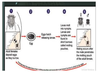Scab Structures Comprehensive Overview of Skin Structure and Scabies Management | PPTX