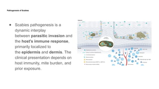 Scabies- Current Views in Dermatovenereology[1].pptx