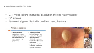 Scabies- Current Views in Dermatovenereology[1].pptx