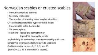Norwegian scabies or crusted scabies
• Immunocomprised patients
• Mentally challenged
• The number of infesting mites may be >1 million.
C/F: widespread crusted, hyperkeratotic lesion
• Innumerable mites (hundreds)
• Very contagious
Treatment - Topical 5% permethrin or
topical 5% benzoyl benzoate
applied daily for seven days, then twice weekly until cure
Keratolytic creams on alternate days to scabicide
Oral ivermectin on days 1, 2, 8, 9, and 15
(add days 22, 29 if infestation is severe).
 