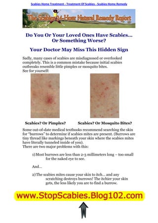 Scabies Home Treatment - Treatment Of Scabies - Scabies Home Remedy




 Do You Or Your Loved Ones Have Scabies…
           Or Something Worse?
    Your Doctor May Miss This Hidden Sign
Sadly, many cases of scabies are misdiagnosed or overlooked
completely. This is a common mistake because initial scabies
outbreaks resemble little pimples or mosquito bites.
See for yourself:




 Scabies? Or Pimples?                Scabies? Or Mosquito Bites?
Some out-of-date medical textbooks recommend searching the skin
for “burrows” to determine if scabies mites are present. (Burrows are
tiny thread like markings beneath your skin where the scabies mites
have literally tunneled inside of you).
There are two major problems with this:

     1) Most burrows are less than 2-3 millimeters long – too small
             for the naked eye to see.

     And…

     2) The scabies mites cause your skin to itch… and any
             scratching destroys burrows! The itchier your skin
             gets, the less likely you are to find a burrow.
 