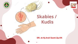 Skabies /
Kudis
DR. dr.Hj.Andi Sastri,Sp.KK
 