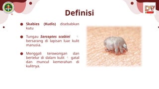 Definisi
● Skabies (Kudis) disebabkan
kutu
● Tungau Sarcoptes scabiei 
bersarang di lapisan luar kulit
manusia.
● Menggali terowongan dan
bertelur di dalam kulit  gatal
dan muncul kemerahan di
kulitnya.
 