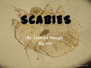 SCABIES
By: Jasmine Stough
      Bio 108




                     Kalumet, 11 June 2004
 