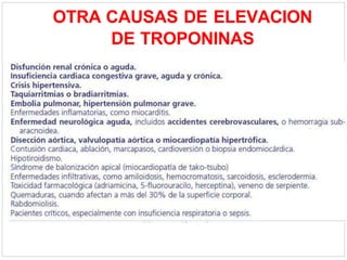 OTRA CAUSAS DE ELEVACION
DE TROPONINAS
 