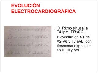 EVOLUCIÓN
ELECTROCARDIOGRÁFICA
.  Ritmo sinusal a
74 lpm. PR<0.2.
Elevación de ST en
V2-V6 y I y aVL, con
descenso especular
en II, III y aVF
 