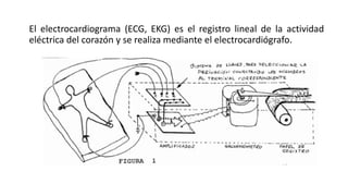El electrocardiograma (ECG, EKG) es el registro lineal de la actividad
eléctrica del corazón y se realiza mediante el electrocardiógrafo.
 