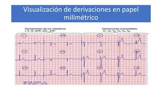 Visualización de derivaciones en papel
milimétrico
 