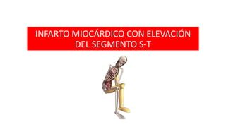 INFARTO MIOCÁRDICO CON ELEVACIÓN
DEL SEGMENTO S-T
 