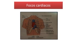 Focos cardiacos
 