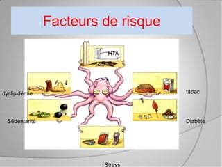 Facteurs de risque

                          HTA




dyslipidémie                         tabac




  Sédentarité                        Diabète




                         Stress
 