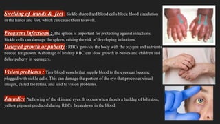 Hemoglobin Apathies ,Causes ,Precautions | PPTX
