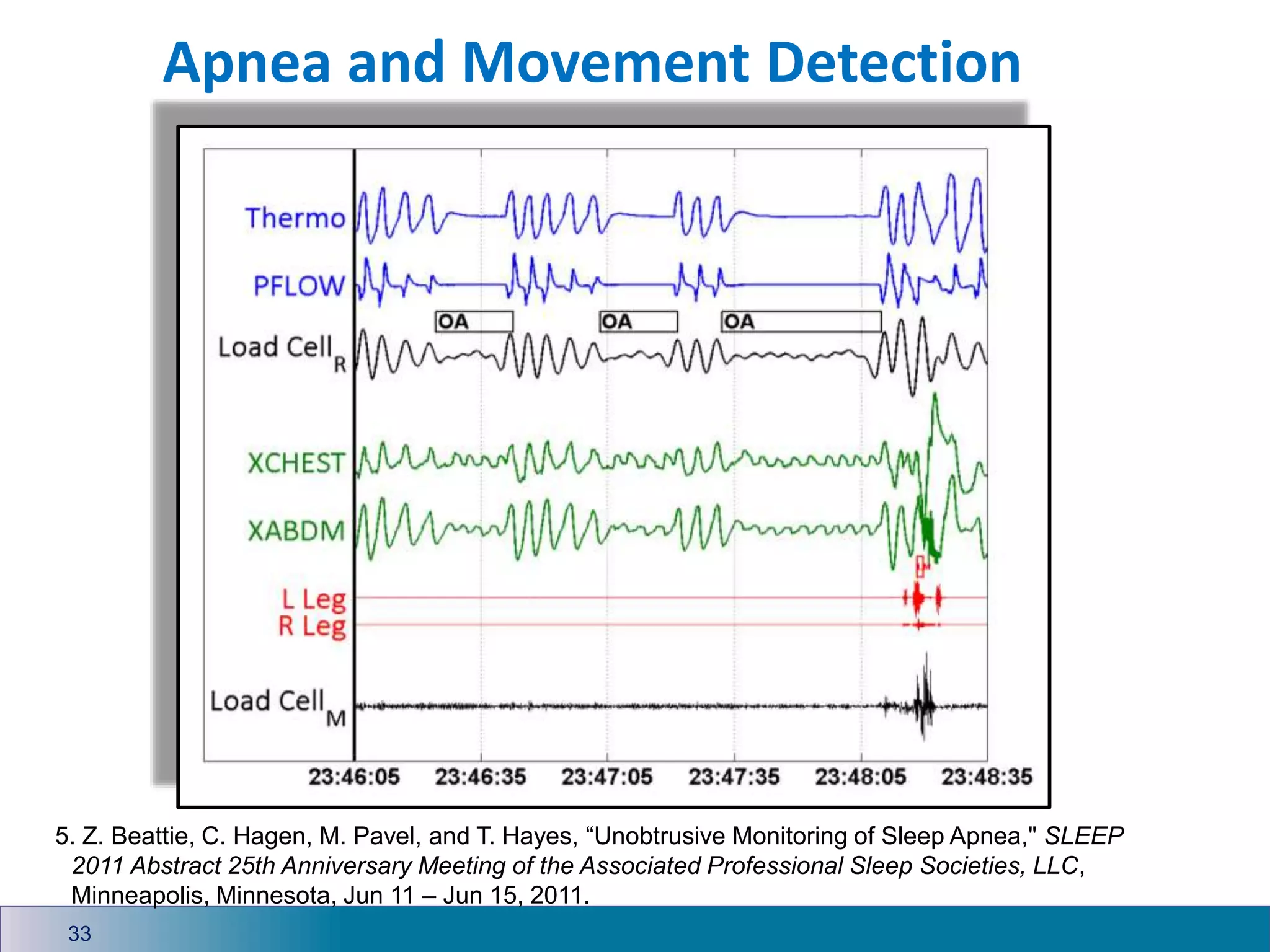 Apnea and Movement Detection
33
5. Z. Beattie, C. Hagen, M. Pavel, and T. Hayes, “Unobtrusive Monitoring of Sleep Apnea," SLEEP
2011 Abstract 25th Anniversary Meeting of the Associated Professional Sleep Societies, LLC,
Minneapolis, Minnesota, Jun 11 – Jun 15, 2011.
 