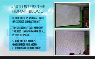 UNCLUSTERS THE
HUMAN BLOOD
BLOOD THICKENS WITH AGE, LACK
OF EXERCISE, UNHEALTHY DIET
THICK BLOOD SETS ALL KINDS OF
SICKNES...
